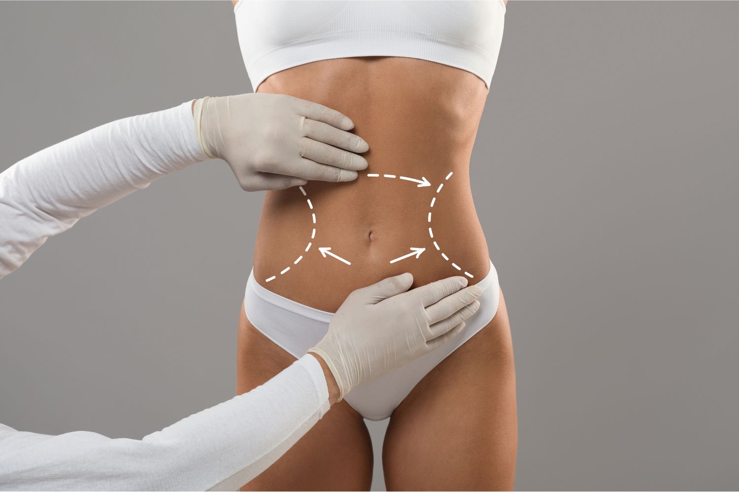exion: non-invasive fat reduction and skin tightening