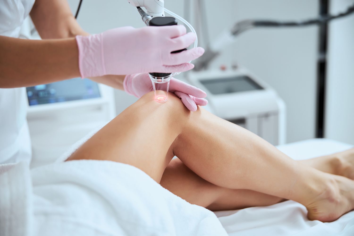 The Benefits of ClearV Laser Vein Treatment