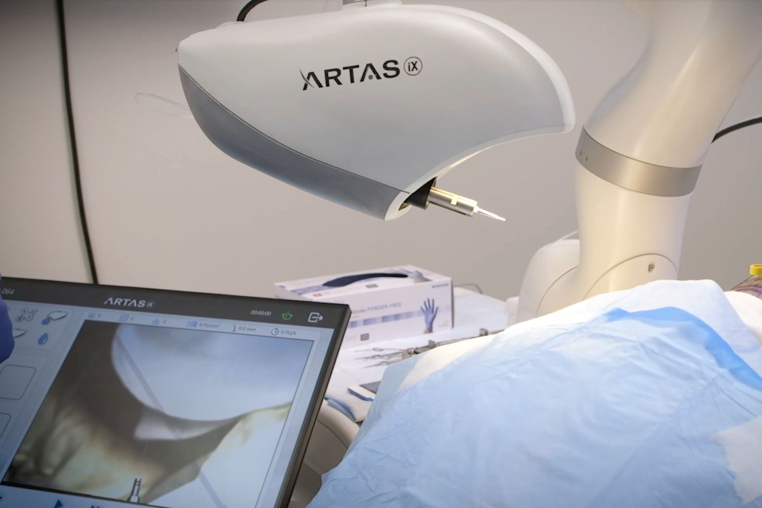 Why ARTAS Robotic Hair Restoration is the Smart Choice for Hair Loss Treatment